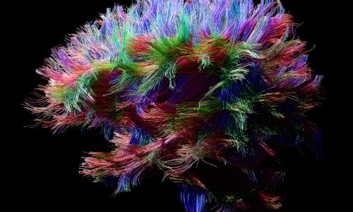 The Brain Synapse Main Image